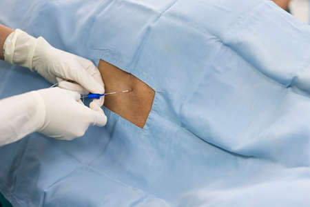 spinal block