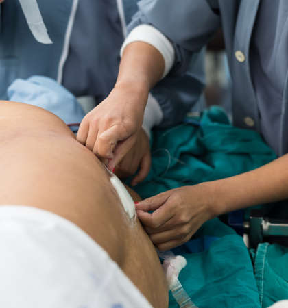 spinal blockの写真素材