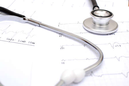 electrocardiogram and stethoscopeの写真素材