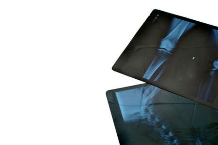 Radiographsの写真素材