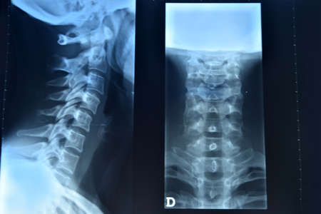 X- Ray backgroundの写真素材