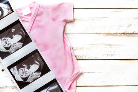Pink baby romper and ultrasound baby on white wooden background. Copyspace.