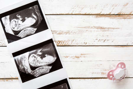 Ultrasound and pacifier on wooden backgroundの写真素材