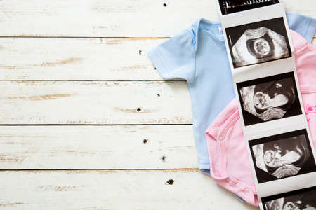 Pink and blue baby romper and ultrasound on white wooden background.Copyspaceの写真素材