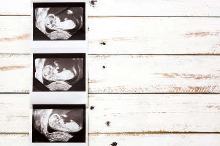 Ultrasound on white wooden backgroundの写真素材