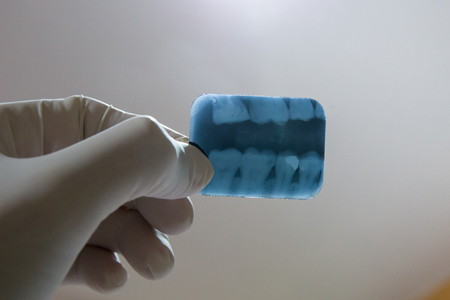 dental radiographの写真素材