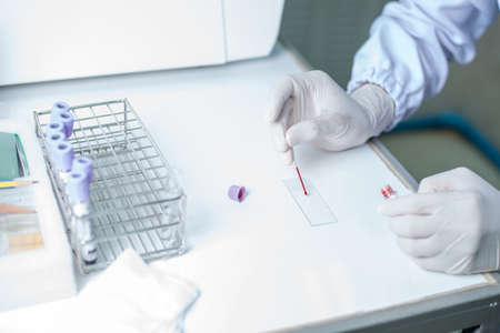 Blood sampling with needle for analysis in laboratoryの写真素材