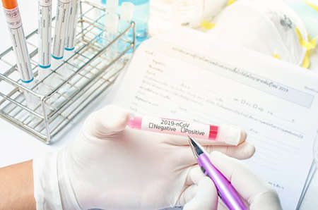 Coronavirus Covid-19 nCoV in Lab. Scientist hold Blood Test. Epidemic virus Respiratory Syndrome. Thailandの写真素材