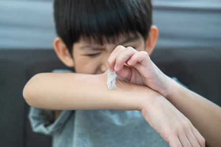 Little Asian boy's hands peeling off dry skin on his arm. Skin problems.の写真素材