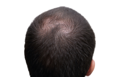closeup background of bald head