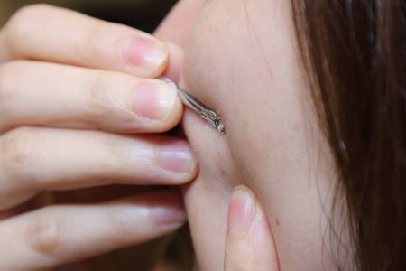 woman use the acne removal stick to remove acne out of her faceの写真素材