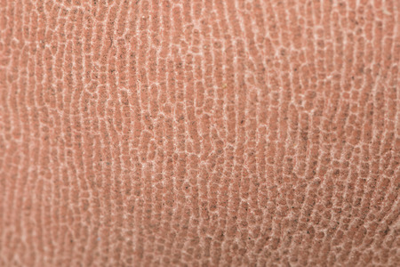 dry foot skin texture