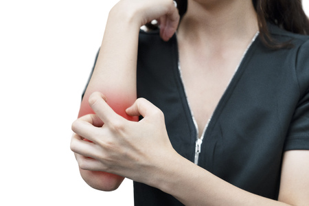 woman with itchy skin scratching her arm