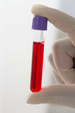 blood test  blood sampleの写真素材