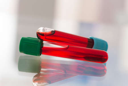 Blood sample in tube.の写真素材