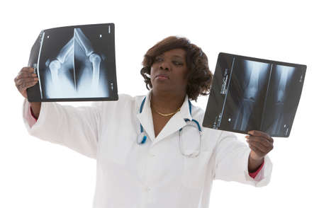 Female doctor examinig radiography