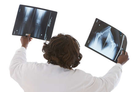Female doctor examinig radiography