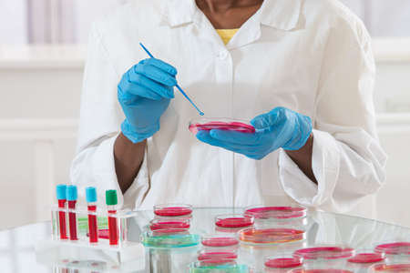 woman laboratory assistant working on  petri dishの写真素材