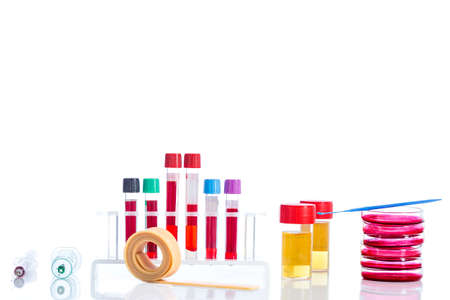 several tubes with blood tubes, plates petri and the background tubes with urine samples