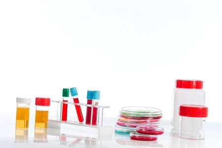 several tubes with blood tubes, plates petri and the background tubes with urine samples