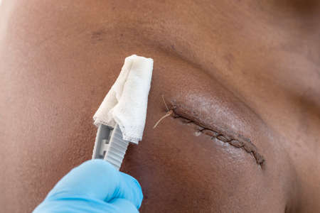 Closeup of a cleaning stitched ON BLACK SKIN