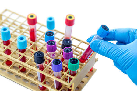 scientist hand taking of one sample from a rack of blood test tubes view from above