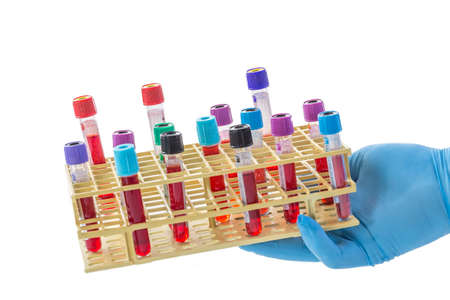 doctor or lab technician hand holnding a rack of blood sample test tubes for laboaratory on white