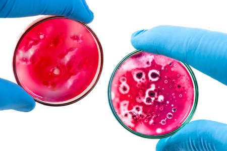 Doctors hands holds Petri dish with bacteria on white backgroundの写真素材