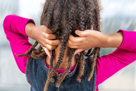 girl itchy her hair on isolated indoors background, health care concept back view