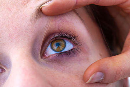 ophthalmologic examinations, fundus of the eyeの写真素材