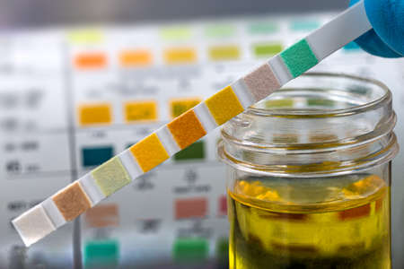 Urine Self-Tests-Self-Measurement close up viewの写真素材