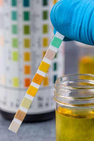 Urine Self-Tests-Self-Measurement close up view