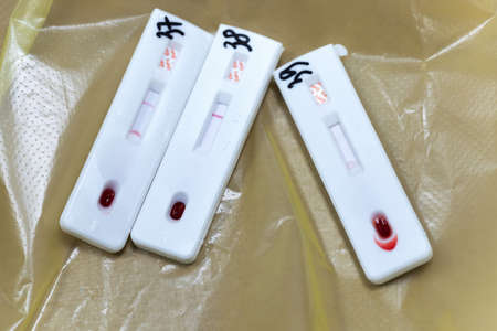 Russian test IHA HIV 1/2-Factor for express diagnosis of specific antibodies to human immunodeficiency virus type I and II in whole blood or in plasma (blood serum). Kamchatka, Russia - Oct 17, 2019のeditorial素材