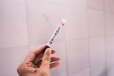Close-Up on patient blood tube of Covid 19 infected With Scientific Lab background..
