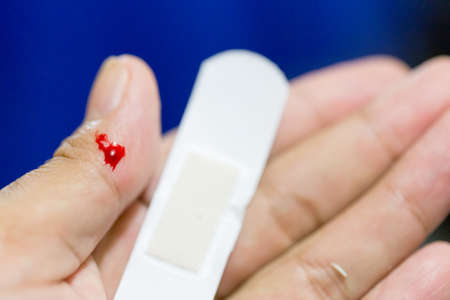 Closeup view of finger on left thumb human hand is cut hurt and bleeding with bright red blood.の写真素材