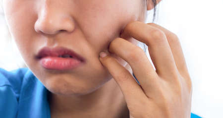 A women is itching and scratching the face.の写真素材