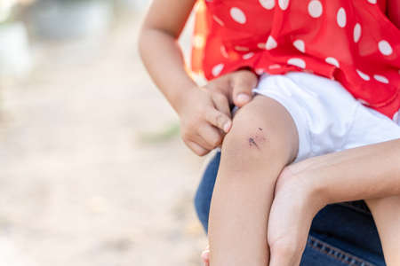 A girl with a knee pain and her abrasion.