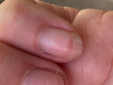 Close-up of a human hand.