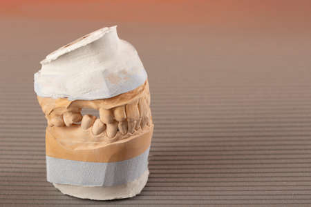 Dental gypsum model. Mold of human teeth. Oral health concept. Close up.の写真素材