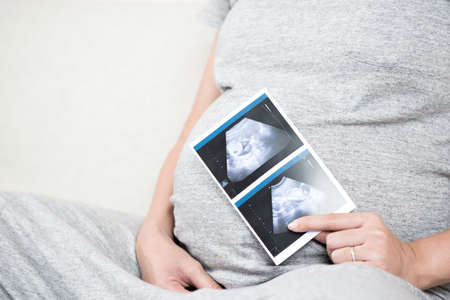 Soft focus and blurry of happy pregnant woman sitting on sofa at home holding and showing ultrasound...