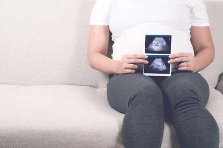 Soft focus and blurry of happy pregnant woman sitting on sofa at home holding and showing ultrasound scan photos. Pregnancy, Fetal examination, Antenatal Care, maternity, healthcare, parent and love.の写真素材
