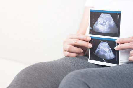 Soft focus and blurry of happy pregnant woman sitting on sofa at home holding and showing ultrasound scan photos. Pregnancy, Fetal examination, Antenatal Care, maternity, healthcare, parent and love.の写真素材