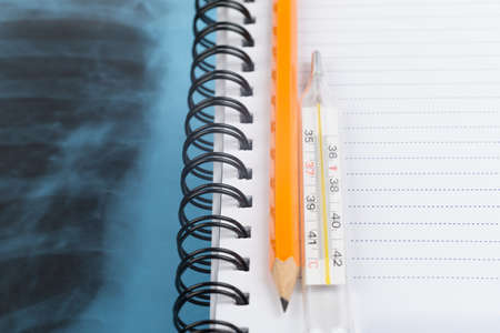 X-ray examination and copy book with pencil, thermometer, close-up viewの写真素材