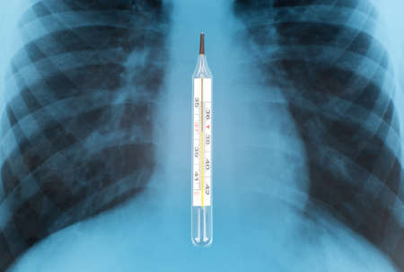 X-ray examination and thermometer in center, close-up viewの写真素材