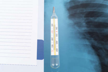 X-ray examination and part of copy book with thermometer, close-up view
