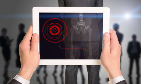 Businessman holding tablet with x-ray of manの写真素材