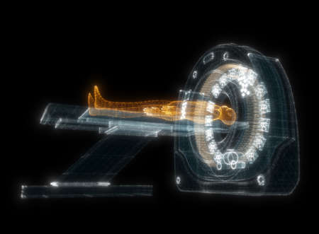 Digital MRI scan with patient Hologram. Medicine and Technology Concept