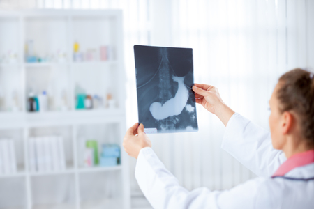 Doctor holding x-ray picture of pancreas