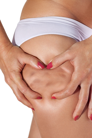 Cellulite and stretch marks shown on womans thighの写真素材