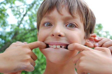 portrait of a boy that fools around stretching mouth with his hands and shows missing thoothの写真素材